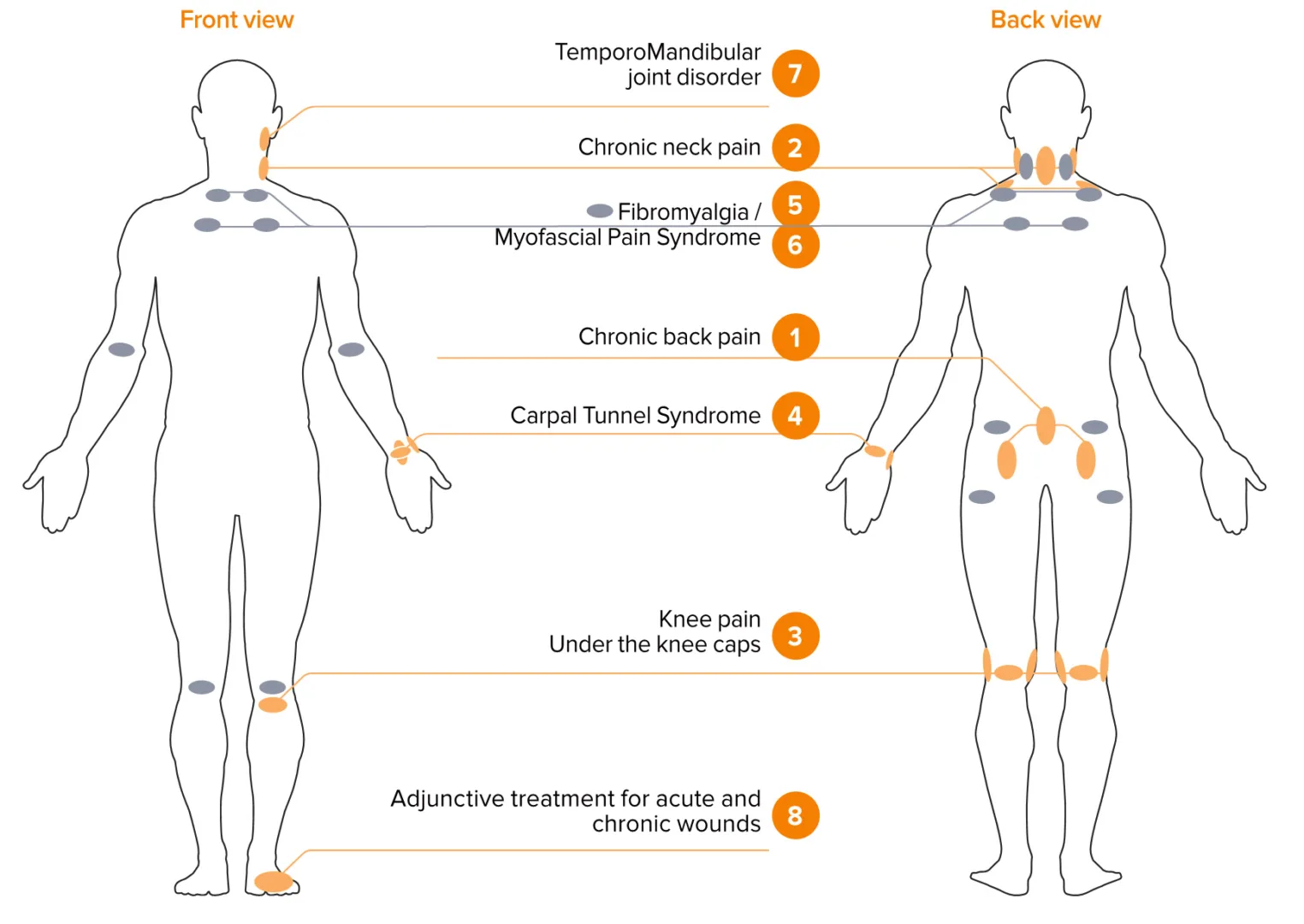 body illustration treatment points